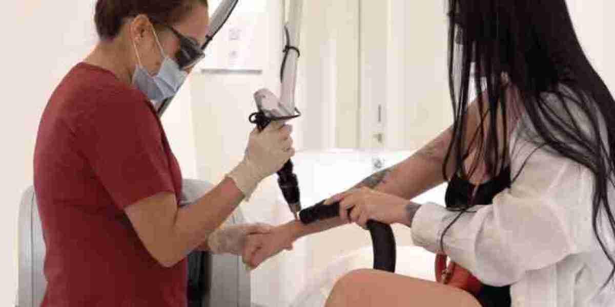 Aftercare Tips for Safe and Effective Tattoo Removal