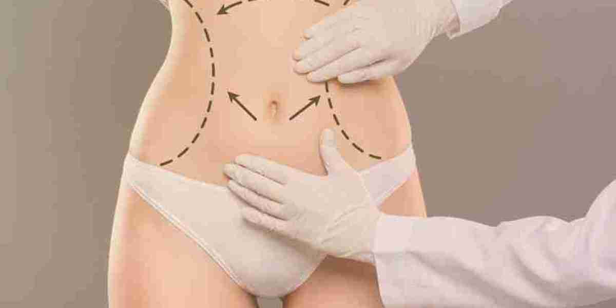 Tummy Tuck Surgery in Dubai - Your Path to a Confident You