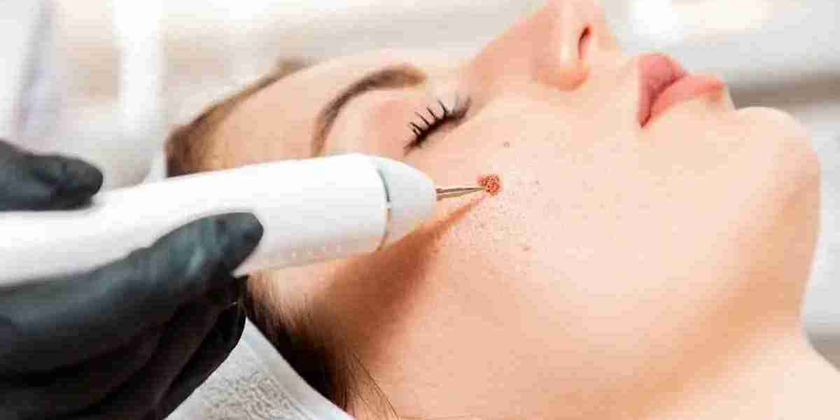 Can warts grow back after removal?