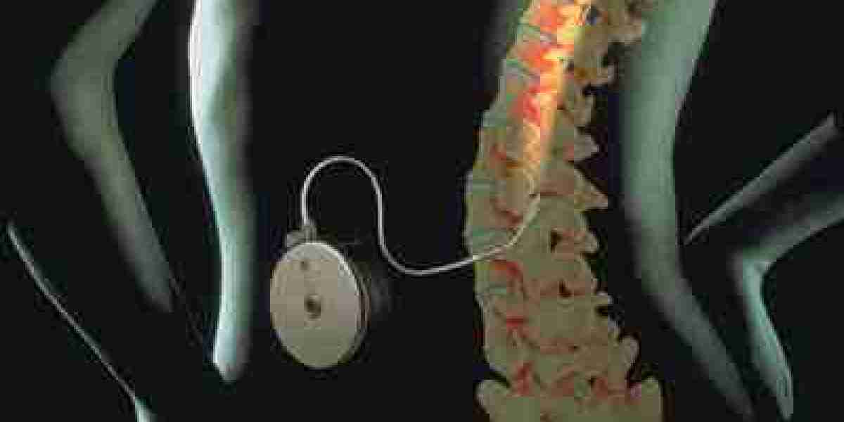Advancing Pain Management: The Growing Intrathecal Pumps Market