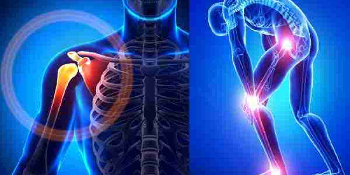 Relieving the Ache: Insights into the Growing Bone Pain Treatment Market