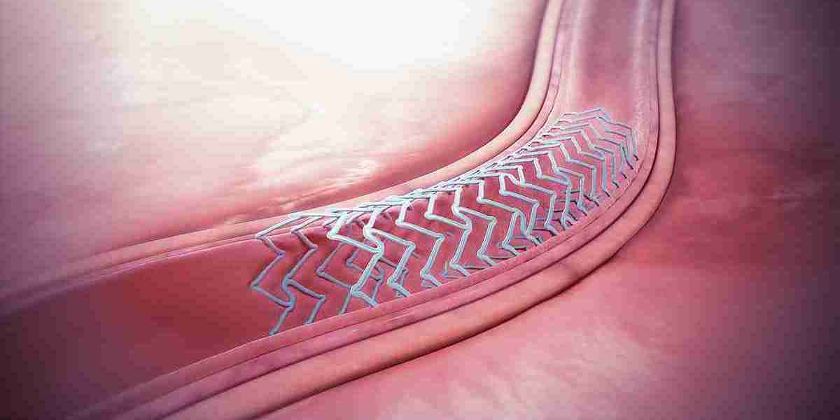 Dissolving Solutions: The Rise of the Bioabsorbable Stents Market