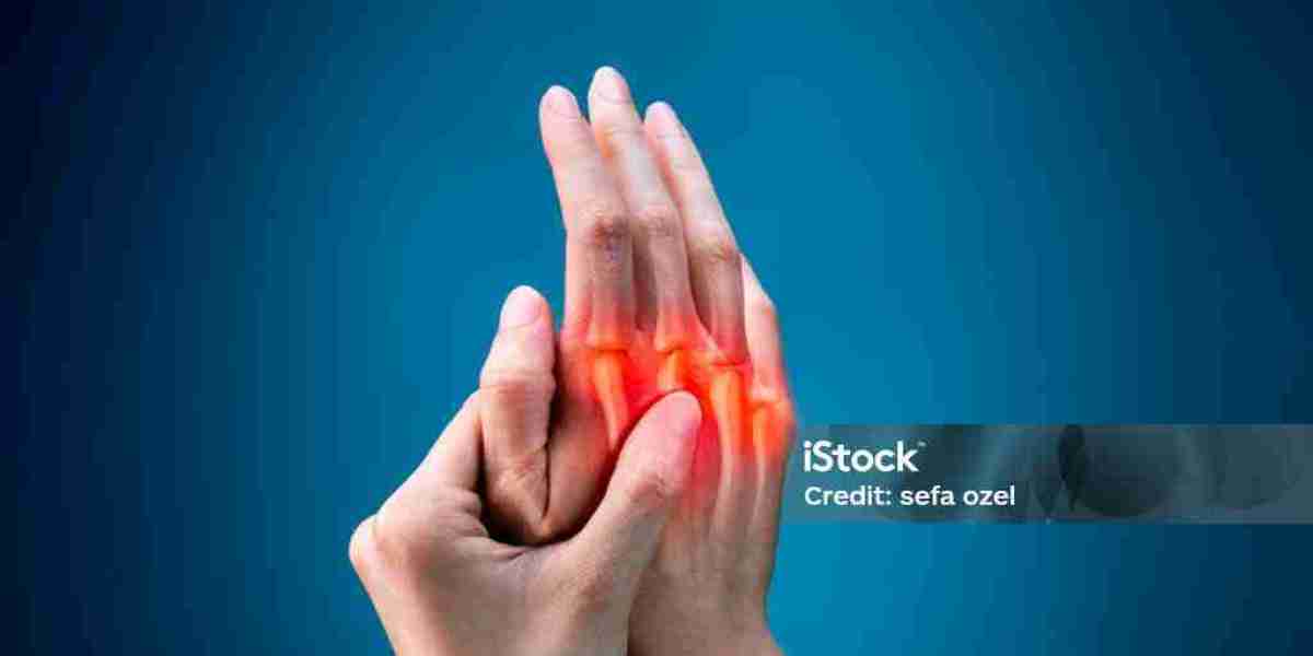 Rheumatoid Arthritis Market Trends 2025: Treatment Innovations and Market Growth