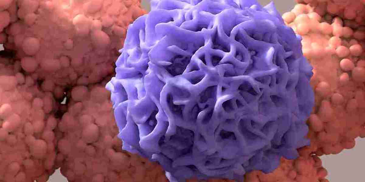 Fighting the "Wasting Syndrome": The Growing Frontier of the Cancer Cachexia Market