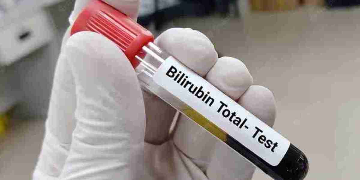 Tracking Health with Precision: The Growing Bilirubin Blood Test Market