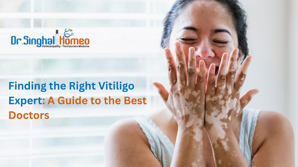 Finding the Best Doctor for Vitiligo Treatment: Exploring Homeopathic Options | by Dr. Singhal Homeo | Jul, 2025 | Medium