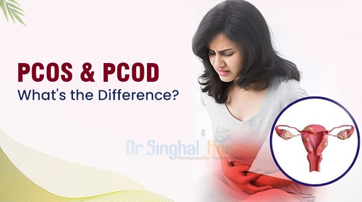 PCOD vs PCOS: Key Differences Explained | Dr. Vikas Singhal
