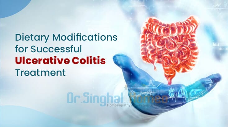 Top Dietary Tips to Manage Ulcerative Colitis Naturally