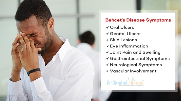 Behcet's Disease: Symptoms, Causes & Natural Homeopathy