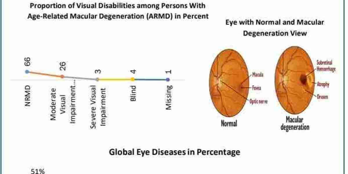 How Is the Aging Population Fueling Growth in the Global AMD Market?