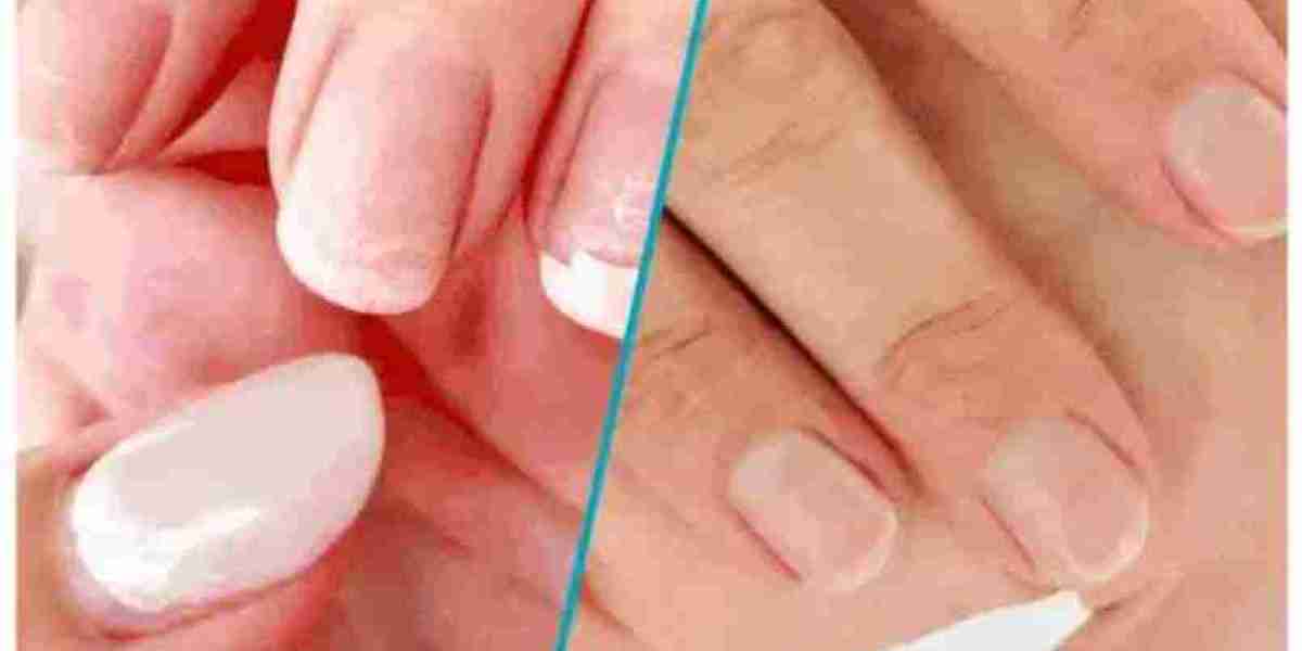 Onsen Nail: The Secret to Healthy, Shiny, and Naturally Beautiful Nails