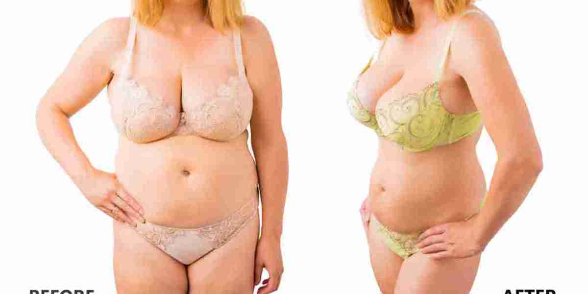 Keto Prime Pro High UK (We Tried It 365) How To Order? Exposed