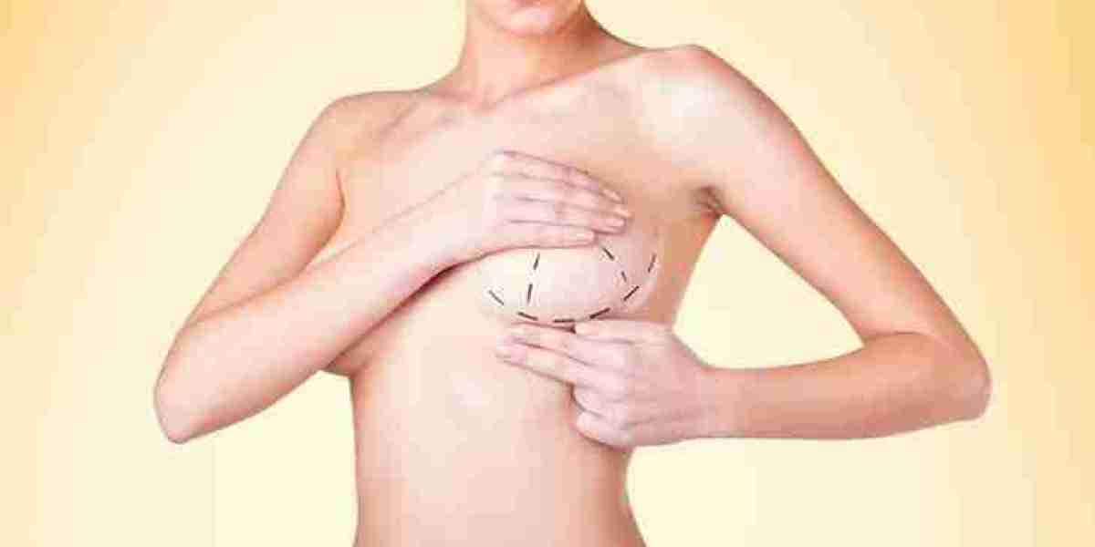 Breast Augmentation Surgery in Dubai with the Best Plastic Surgeon in Dubai – Dr. Anshu Plastic Surgeon