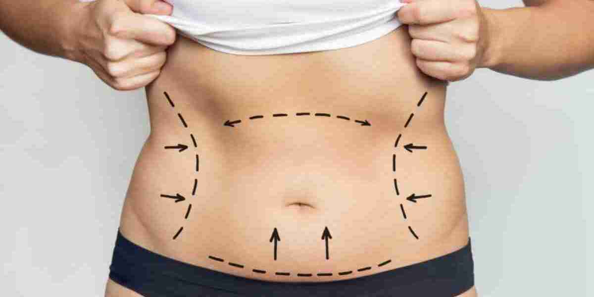 Defined Results with Best Liposuction Surgeon in Dubai