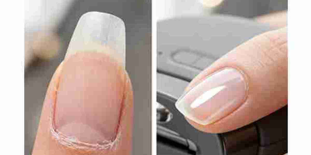 https://www.facebook.com/groups/trimzaelectricnailclipperaustraliauses/