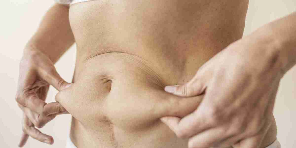 Set Body Goals With Best Liposuction Surgeons in Dubai