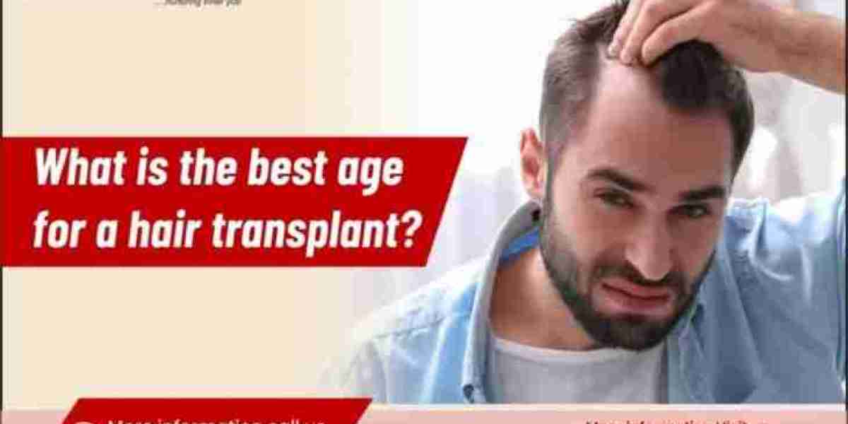 Best Age for Hair Transplant & Hair Transplant Cost in Delhi | Derma Clinix Guide