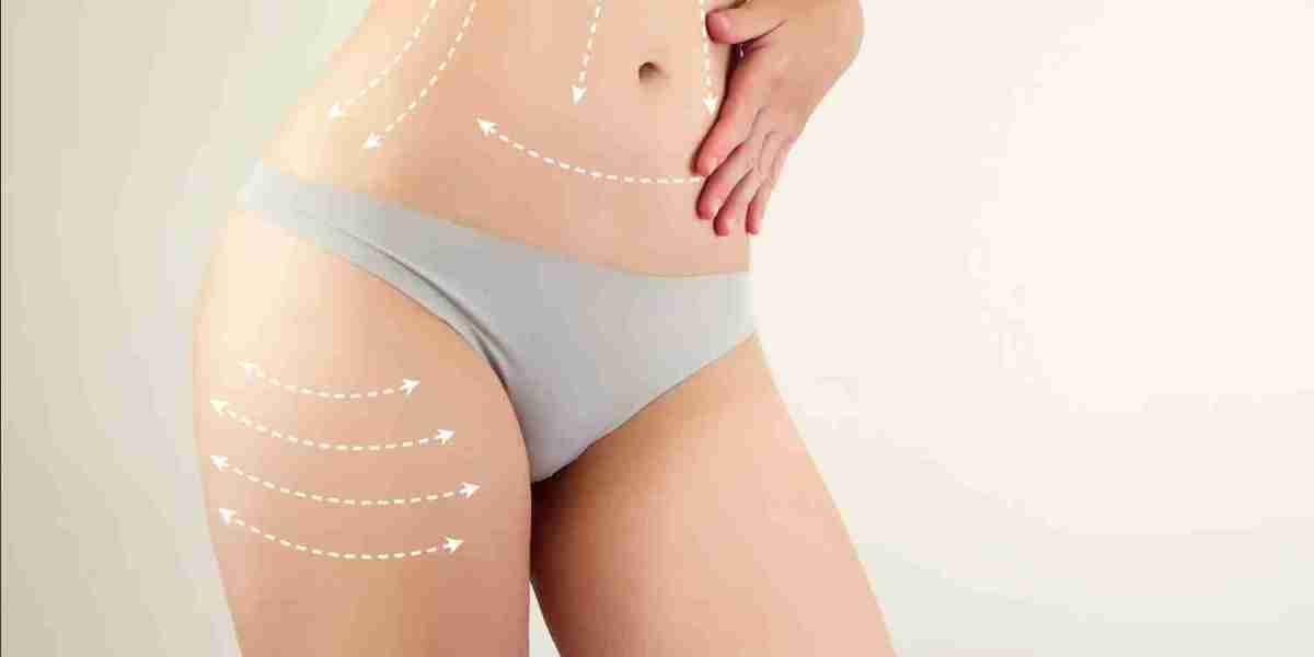Your Ultimate Liposuction Surgery Guide in Dubai