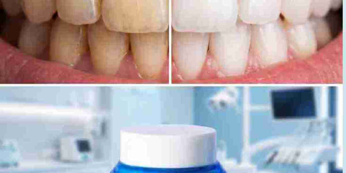 Bloom White Teeth Whitening Powder