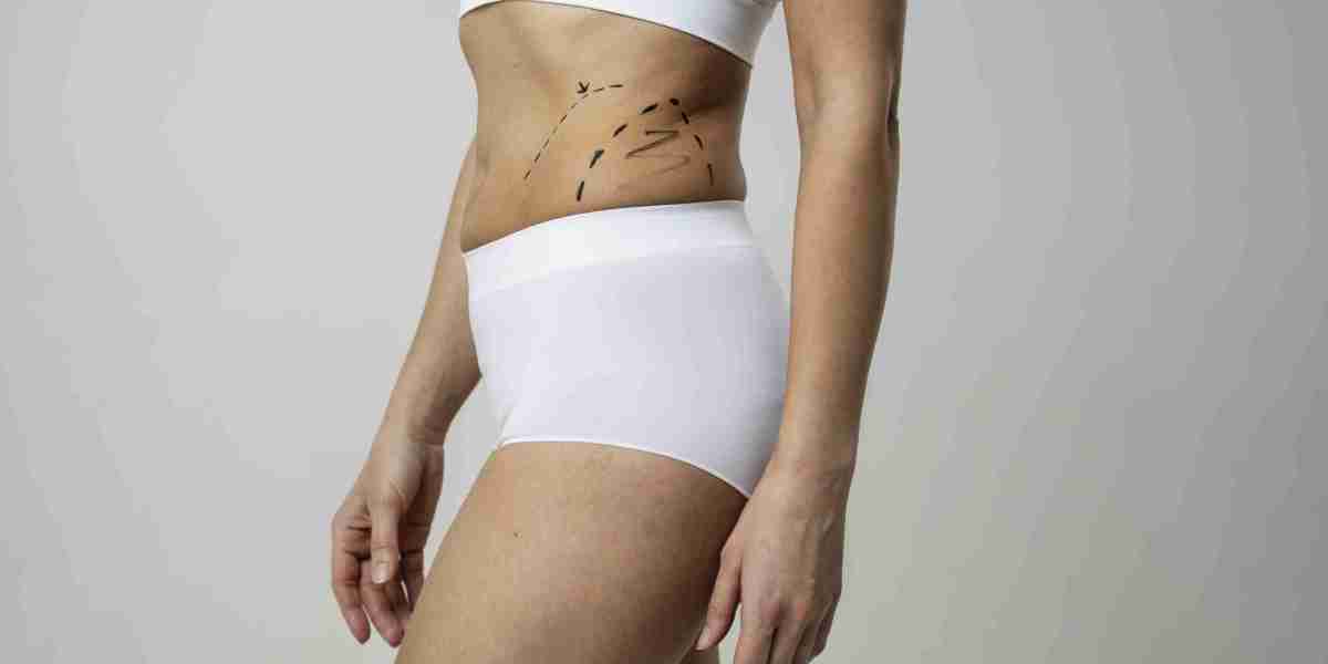 Best Liposuction Doctors in Dubai for Perfect Your Look