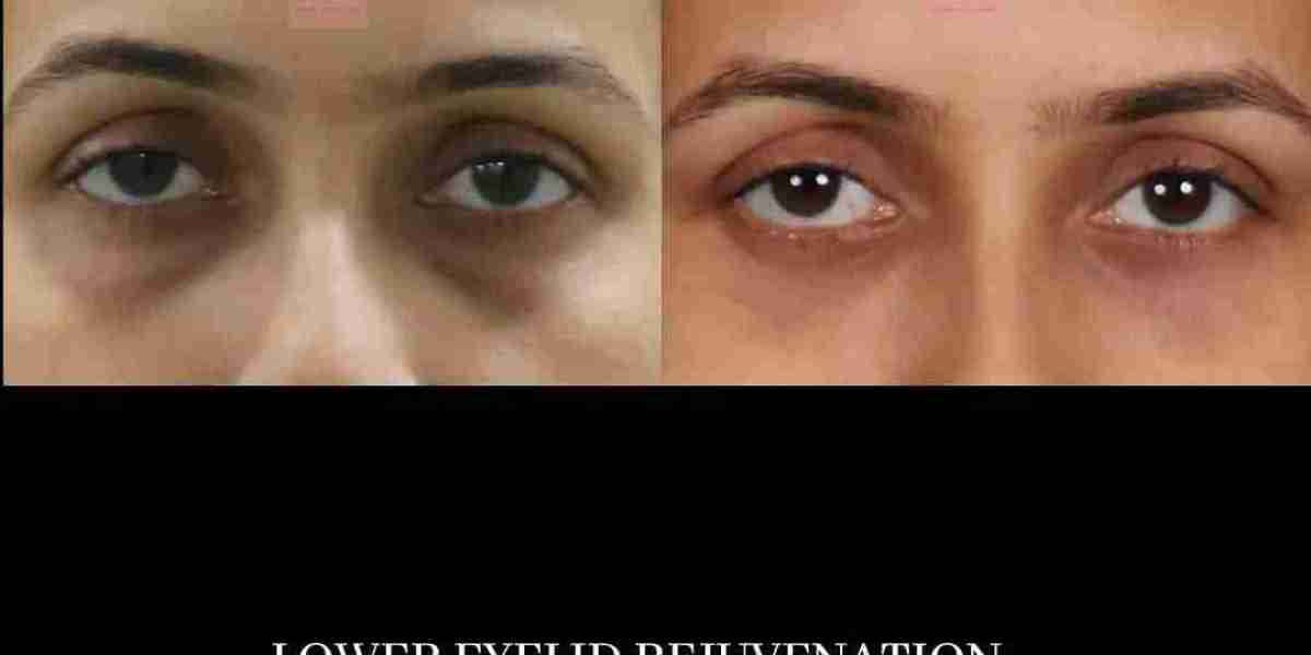 Handa Aesthetics: Choosing a Cosmetic Plastic Surgeon in Delhi